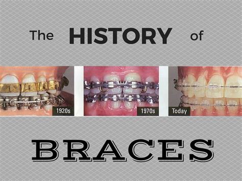 evolution of the old brackets